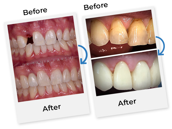 Affordable Dental Care in Los Angeles